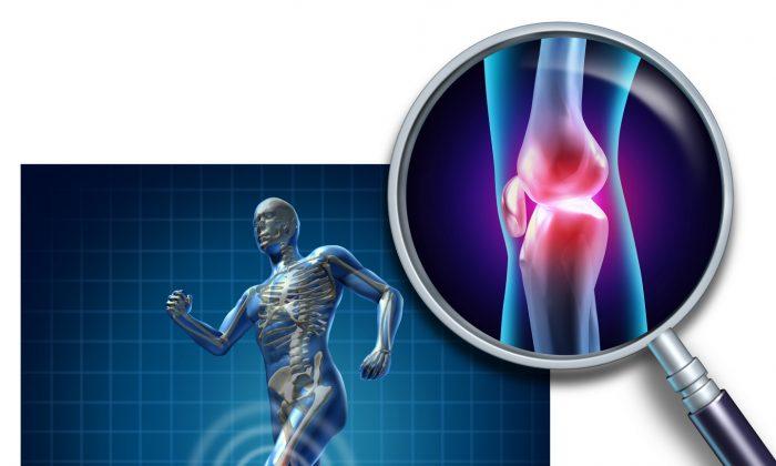 2 Types of Osteoarthritis and 4 Methods of Prevention