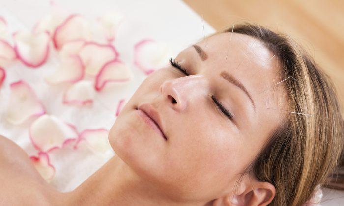 A Natural Alternative to Botox: Facial Acupuncture