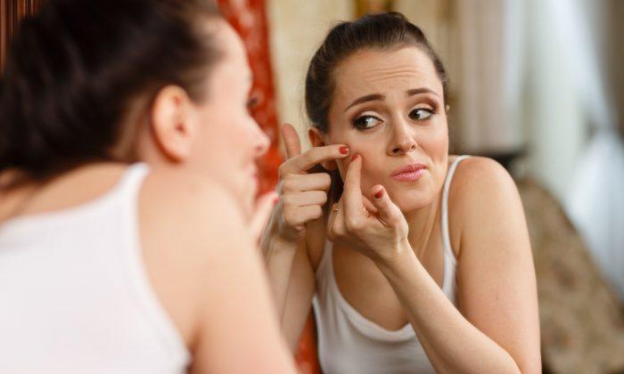 5 Acne Zones That Can Help Pinpoint Underlying Health Causes of Breakouts