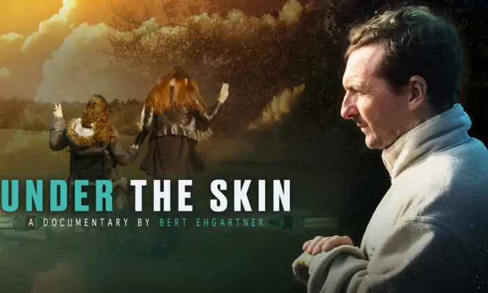Under the Skin | Documentary