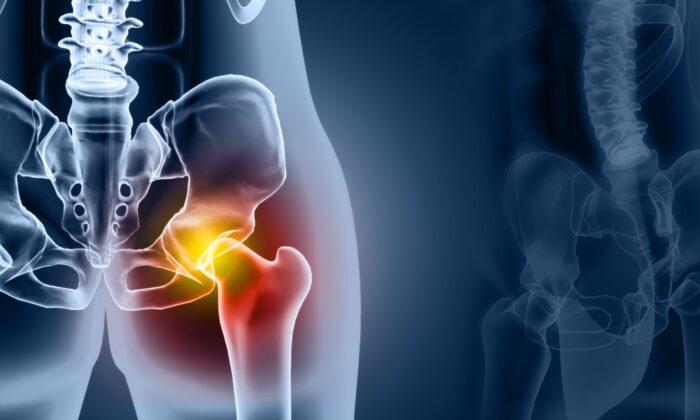 Osteoarthritis Has Doubled in the Last 50 Years