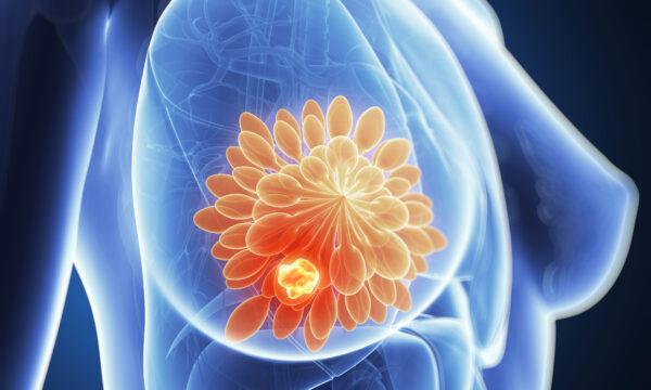 New Saliva Test for Breast Cancer Shows Promise, But Limitations Exist