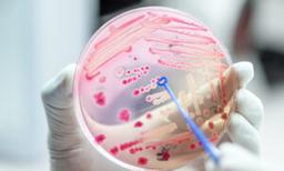 As Antibiotic-Resistance Threat Grows, Treatment Is Becoming ‘More Complicated’: Expert