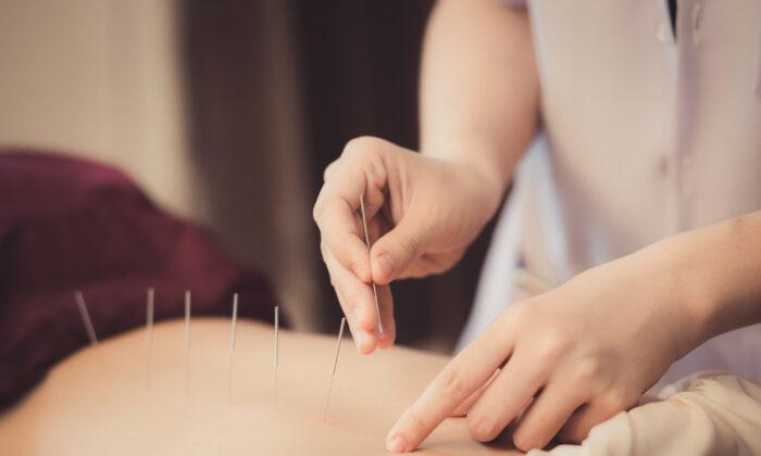 Acupuncture Improves Outcomes for Dialysis Patients: Study