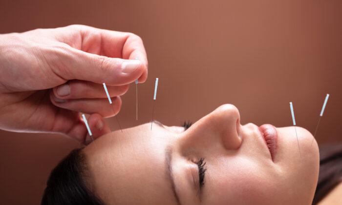 Chrono-Acupuncture for Facial Rejuvenation and Cosmetic Enhancement