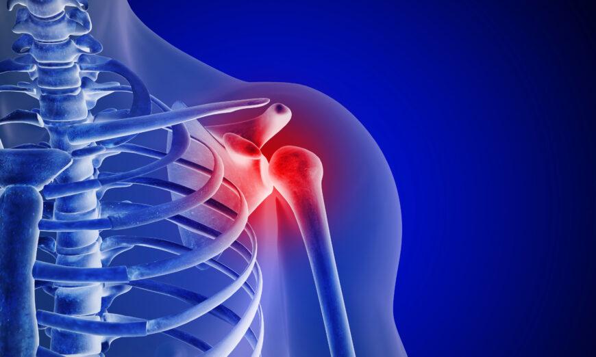 Chronic Shoulder Pain: Often Caused by Muscular Imbalances, 5 Exercises to Restore Movement, Strength, and Balance