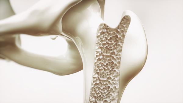 A Functional Approach to Osteoporosis and Bone Health