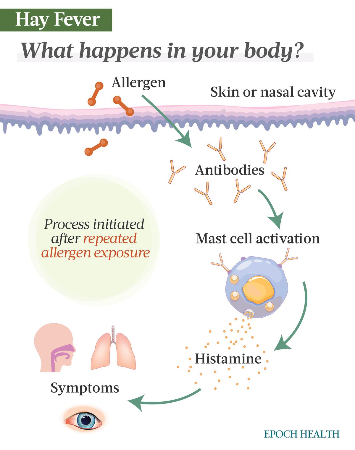  Upon repeated exposure to an allergen, the immune system produces antibodies called immunoglobulin E (IgE), which activate mast cells (white blood cells) that release histamines to ward off the allergen. This process results in hay fever symptoms. (Illustrations from Shutterstock/Designed by The Epoch Times)