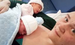 Mom Gives Birth to 'Rare Simultaneous' Twin Son and Daughter—Born at Exactly the Same Time