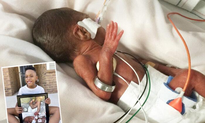 Baby Born at 22 Weeks Due to Mom's Infection Is Now Thriving—He Was So Small He Could Wear Dad's Wedding Ring as a Bracelet