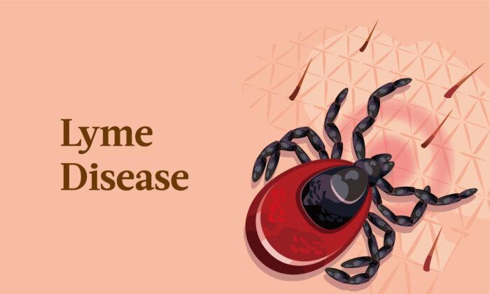 The Essential Guide to Lyme Disease: Symptoms, Causes, Treatments, and Natural Approaches