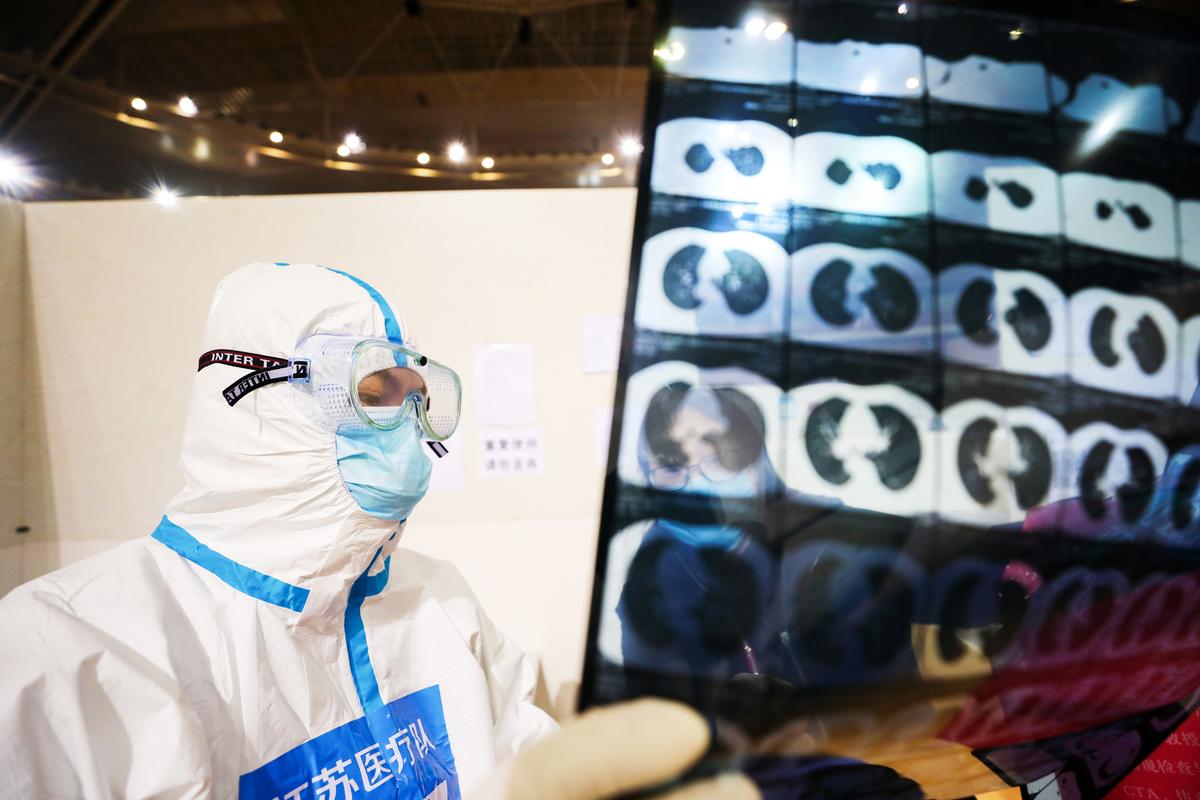 A doctor looks at a patient's CT scan at a temporary hospital set up for COVID-19 patients in a sports stadium in Wuhan, Hubei Province, China, on March 5, 2020. (STR/AFP via Getty Images)