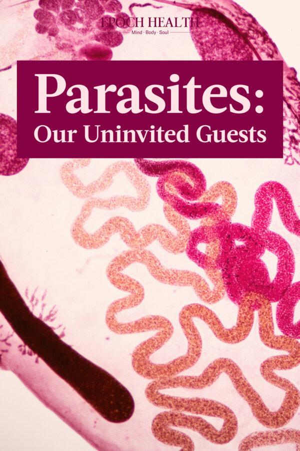 Parasites: Our Uninvited Guests