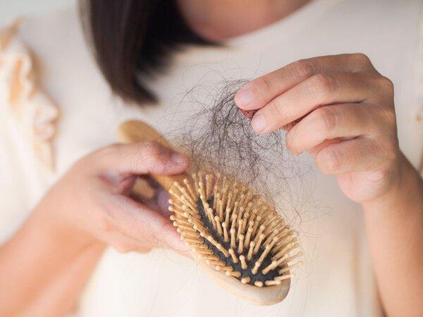 What Does Hair Loss Signal About Your Health? Treatment and Prevention Strategies
