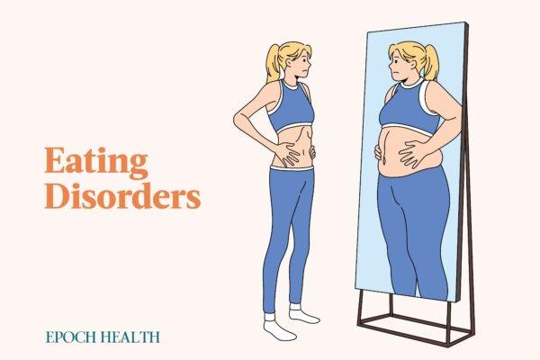 The Essential Guide to Eating Disorders: Symptoms, Causes, Treatments, and Natural Approaches