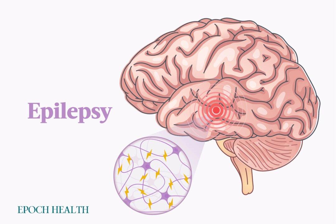 Epilepsy: Symptoms, Causes, Treatments, and Natural Approaches