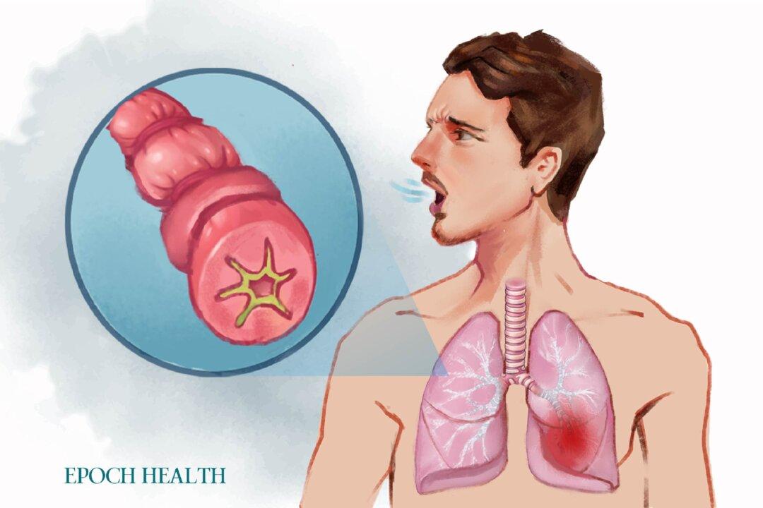 Asthma: Symptoms, Causes, Treatments, and Natural Approaches