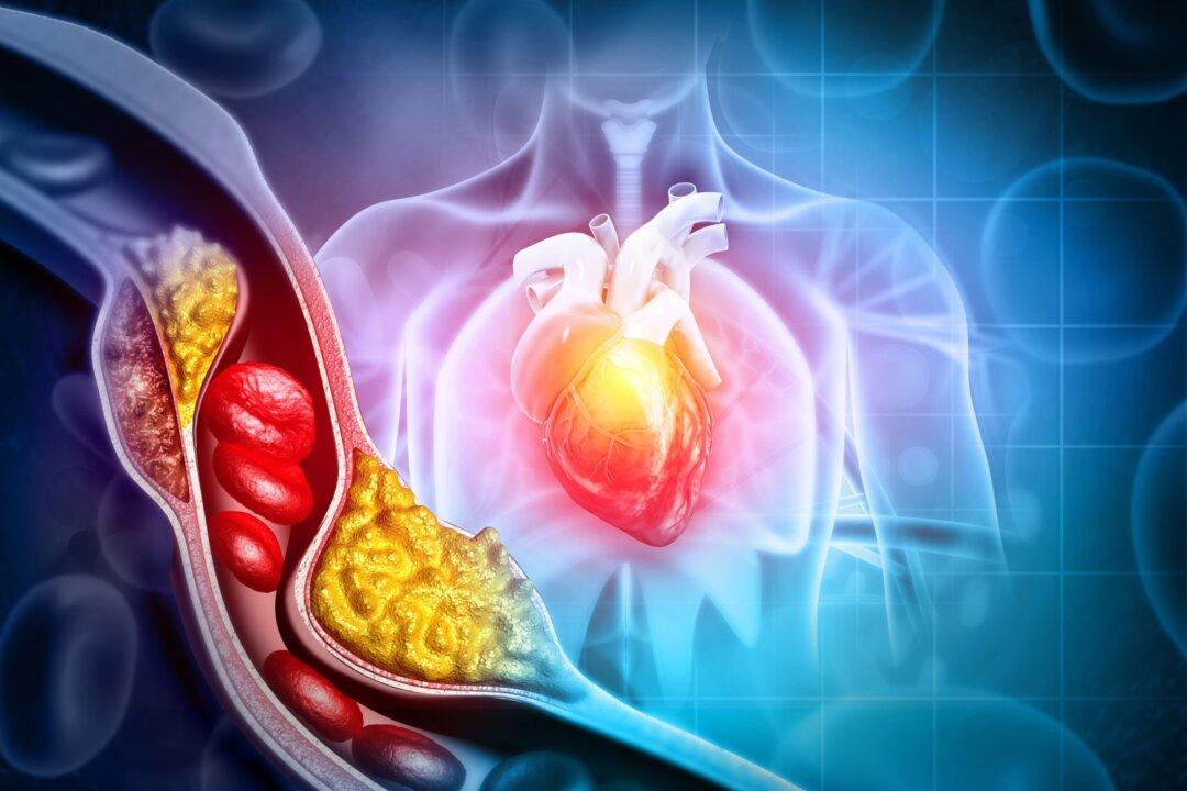 New Study Shows How Gut Bacteria Break Down Cholesterol