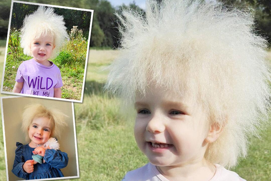 Girl With Frizzy Hair Nicknamed ‘Fluffy’ by Friends—She’s One of Only 100 People in the World With This Syndrome